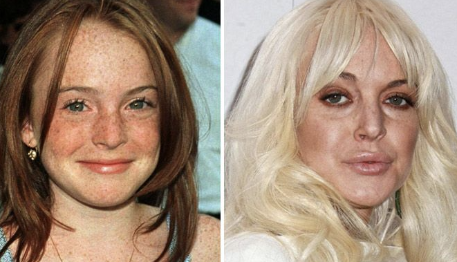 Celebs Who Have Aged Terribly